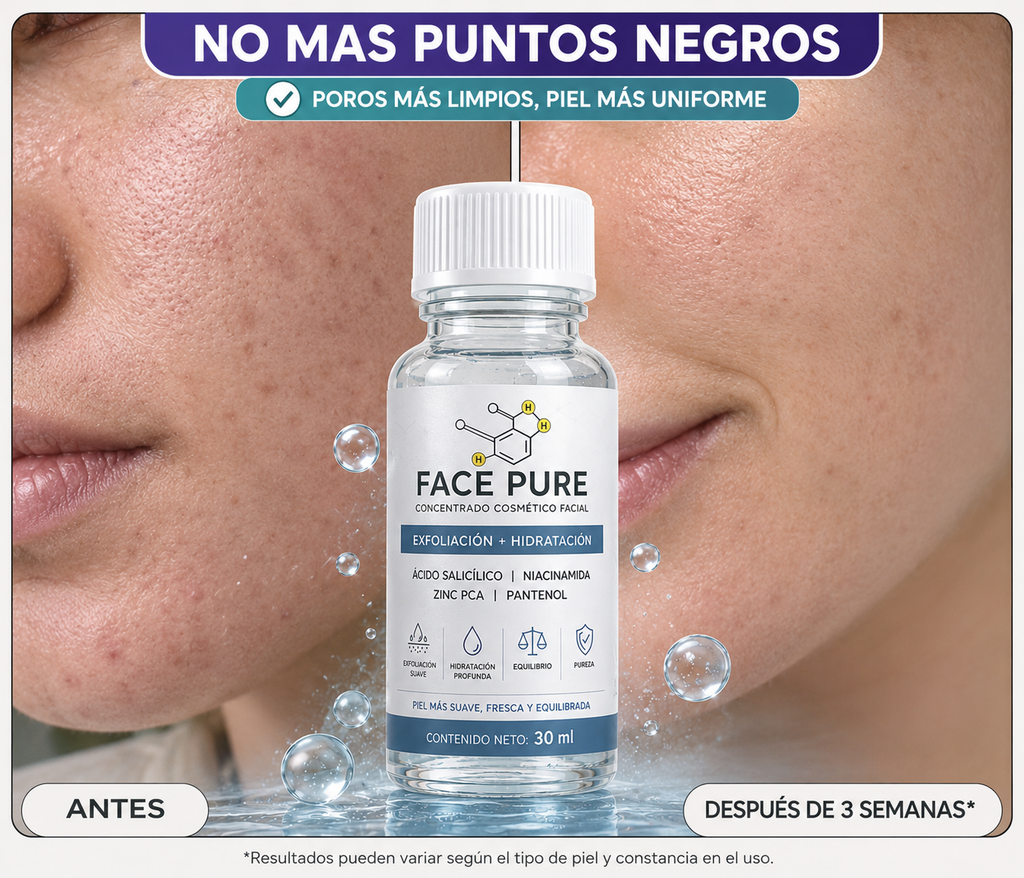 FACE PURE Tratamiento Localizado