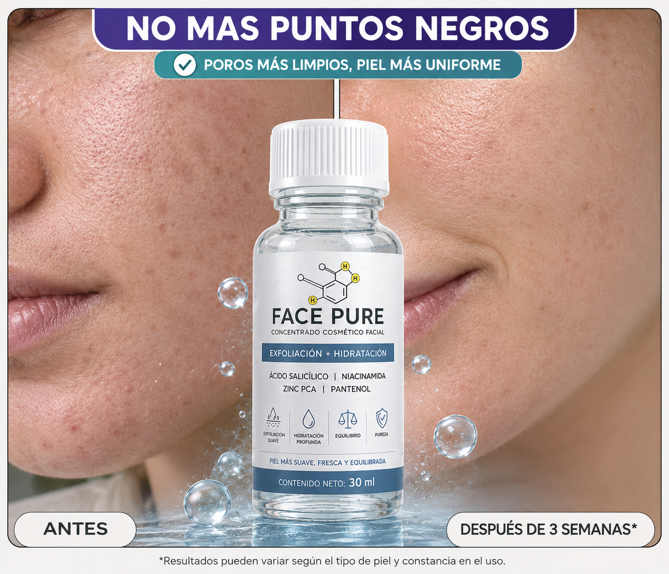 FACE PURE Tratamiento Localizado